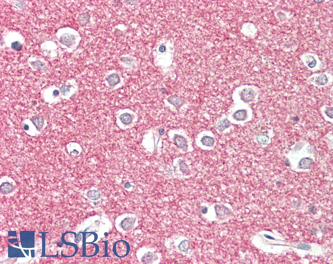 STX1A / STX1B Antibody - Anti-STX1A/STX1B2 antibody IHC staining of human brain, cortex. Immunohistochemistry of formalin-fixed, paraffin-embedded tissue after heat-induced antigen retrieval. Antibody concentration 5 ug/ml.
