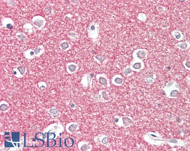 STX1A / STX1B Antibody - Anti-STX1A/STX1B2 antibody IHC staining of human brain, cortex. Immunohistochemistry of formalin-fixed, paraffin-embedded tissue after heat-induced antigen retrieval. Antibody concentration 5 ug/ml.