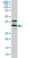 STX5 / Syntaxin 5 Antibody - STX5A monoclonal antibody clone 5A6 Western blot of STX5A expression in A-431.