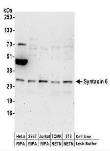 STX6 / Syntaxin 6 Antibody - Detection of Human and Mouse Syntaxin 6 by Western Blot. Samples: Whole cell lysate (50 ug) prepared using NETN or RIPA buffer from HeLa, 293T, Jurkat, mouse TCMK-1, and mouse NIH3T3 cells. Antibodies: Affinity purified rabbit anti-Syntaxin 6 antibody used for WB at 0.1 ug/ml. Detection: Chemiluminescence with an exposure time of 3 minutes.