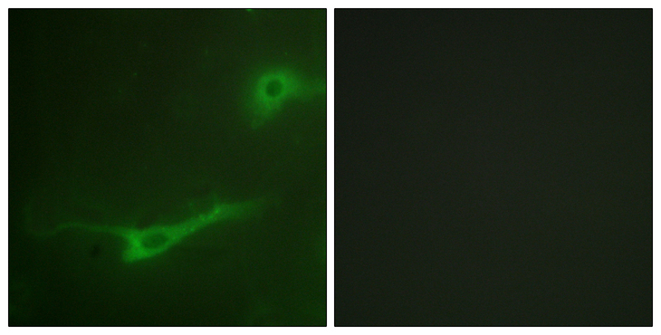 STXBP1 / MUNC18-1 Antibody - Immunofluorescence analysis of NIH/3T3 cells, using MUNC-18a Antibody. The picture on the right is blocked with the synthesized peptide.
