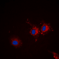 STXBP1 / MUNC18-1 Antibody - Immunofluorescent analysis of p67 staining in Jurkat cells. Formalin-fixed cells were permeabilized with 0.1% Triton X-100 in TBS for 5-10 minutes and blocked with 3% BSA-PBS for 30 minutes at room temperature. Cells were probed with the primary antibody in 3% BSA-PBS and incubated overnight at 4 deg C in a humidified chamber. Cells were washed with PBST and incubated with a DyLight 594-conjugated secondary antibody (red) in PBS at room temperature in the dark. DAPI was used to stain the cell nuclei (blue).