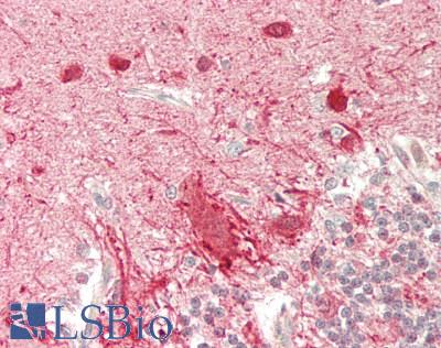 STXBP1 / MUNC18-1 Antibody - Human Brain, Cerebellum: Formalin-Fixed, Paraffin-Embedded (FFPE)