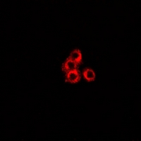 STXBP2 Antibody - Immunofluorescent analysis of Unc18-2 staining in A549 cells. Formalin-fixed cells were permeabilized with 0.1% Triton X-100 in TBS for 5-10 minutes and blocked with 3% BSA-PBS for 30 minutes at room temperature. Cells were probed with the primary antibody in 3% BSA-PBS and incubated overnight at 4 deg C in a humidified chamber. Cells were washed with PBST and incubated with a DyLight 594-conjugated secondary antibody (red) in PBS at room temperature in the dark.