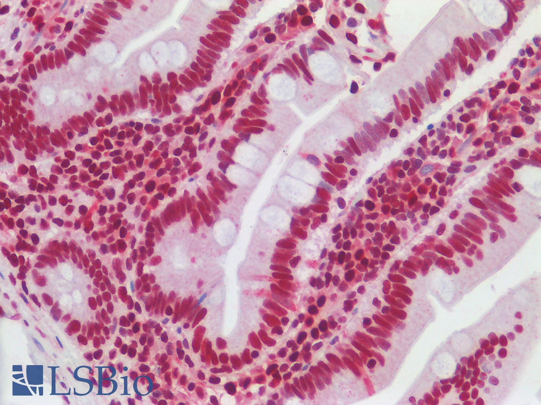 SUB1 Antibody - Human Small Intestine: Formalin-Fixed, Paraffin-Embedded (FFPE)