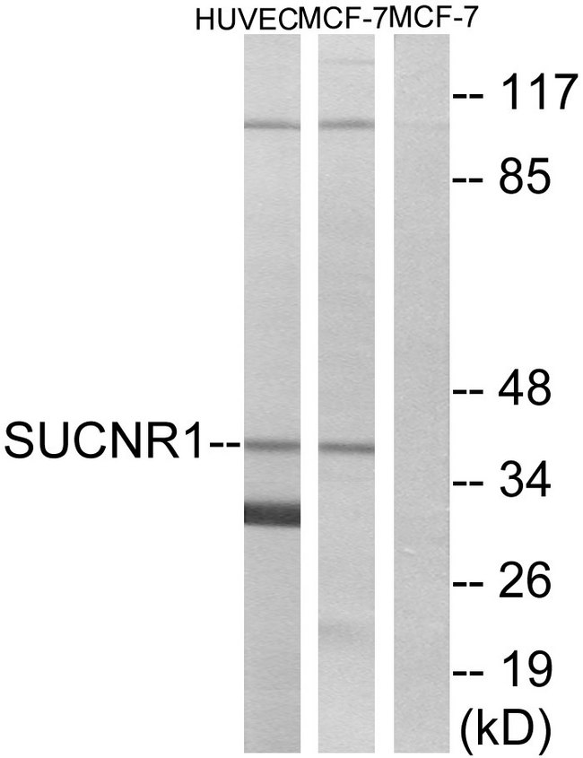 SUCNR1 / GPR91 Antibody - Western blot analysis of lysates from HUVEC and MCF-7 cells, using SUCNR1 Antibody. The lane on the right is blocked with the synthesized peptide.