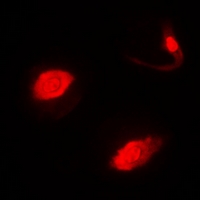 SUFU Antibody - Immunofluorescent analysis of SUFU staining in MCF7 cells. Formalin-fixed cells were permeabilized with 0.1% Triton X-100 in TBS for 5-10 minutes and blocked with 3% BSA-PBS for 30 minutes at room temperature. Cells were probed with the primary antibody in 3% BSA-PBS and incubated overnight at 4 deg C in a humidified chamber. Cells were washed with PBST and incubated with a DyLight 594-conjugated secondary antibody (red) in PBS at room temperature in the dark.