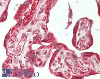 SUFU Antibody - Human Placenta: Formalin-Fixed, Paraffin-Embedded (FFPE)