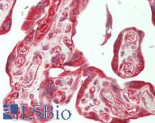 SUFU Antibody - Human Placenta: Formalin-Fixed, Paraffin-Embedded (FFPE)
