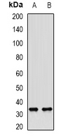 SULT1A1 / Sulfotransferase 1A1 Antibody - Western blot analysis of SULT1A1 expression in mouse liver (A); rat liver (B) whole cell lysates.