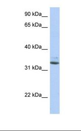 SULT1A1 / Sulfotransferase 1A1 Antibody - Fetal liver lysate. Antibody concentration: 1.0 ug/ml. Gel concentration: 12%.  This image was taken for the unconjugated form of this product. Other forms have not been tested.