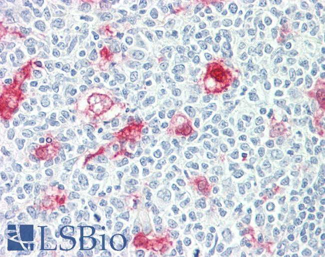 SULT1C2 / Sulfotransferase 1C2 Antibody - Anti-SULT1C2 antibody IHC staining of human tonsil. Immunohistochemistry of formalin-fixed, paraffin-embedded tissue after heat-induced antigen retrieval.