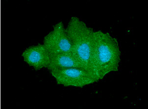 SULT2A1 / Sulfotransferase 2A1 Antibody - ICC/IF analysis of SULT2A1 in Hep3B The cell was stained with SULT2A1 antibody (1:100).The secondary antibody (green) was used Alexa Fluor 488. DAPI was stained the cell nucleus (blue).