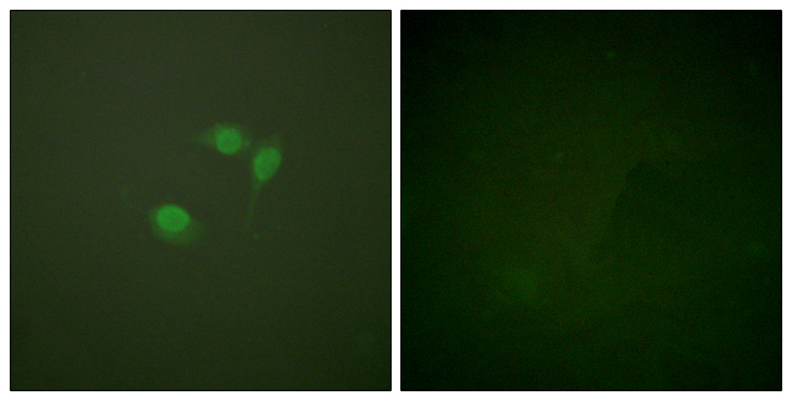 SUMO1 / SMT3 Antibody - Immunofluorescence analysis of NIH/3T3 cells, using Sumo1 Antibody. The picture on the right is blocked with the synthesized peptide.