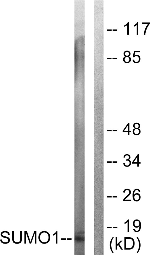 SUMO1 / SMT3 Antibody - Western blot analysis of lysates from 293 cells, using Sumo1 Antibody. The lane on the right is blocked with the synthesized peptide.