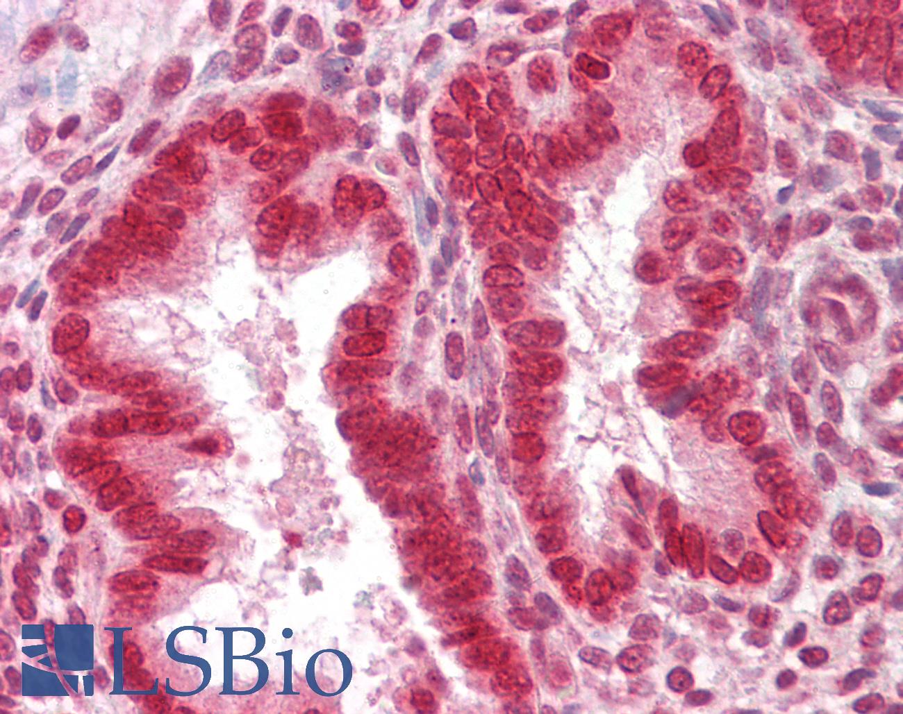 SUMO1 / SMT3 Antibody - Anti-SUMO1 antibody IHC of human uterus. Immunohistochemistry of formalin-fixed, paraffin-embedded tissue after heat-induced antigen retrieval. Antibody dilution 1:100.