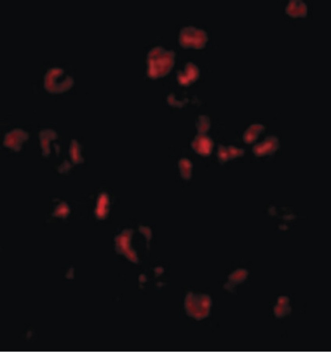SUMO1 / SMT3 Antibody - Immunofluorescence of Sumo in HL60 cells with Sumo antibody at 20 ug/ml.