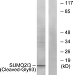SUMO2 Antibody - Western blot of extracts from HeLa cells, using SUMO2/3 (Cleaved-Gly93) Antibody. The lane on the right is treated with the synthesized peptide.