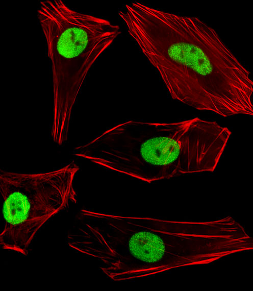 SUMO2 + SUMO3 Antibody - Fluorescent image of SH-SY5Y cells stained with SUMO2/3 Antibody. Antibody was diluted at 1:100 dilution. An Alexa Fluor 488-conjugated goat anti-rabbit lgG at 1:400 dilution was used as the secondary antibody (green). Cytoplasmic actin was counterstained with Alexa Fluor 555 conjugated with Phalloidin (red).