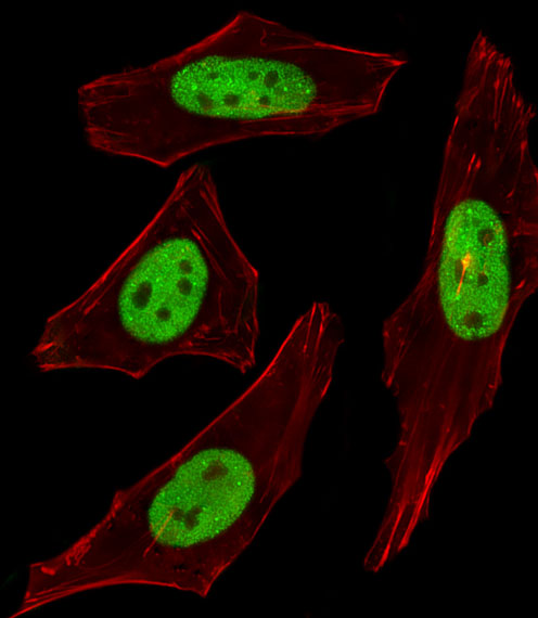 SUMO2 + SUMO3 Antibody - Fluorescent image of HeLa cells stained with SUMO2/3 Antibody. Antibody was diluted at 1:100 dilution. An Alexa Fluor 488-conjugated goat anti-rabbit lgG at 1:400 dilution was used as the secondary antibody (green). Cytoplasmic actin was counterstained with Alexa Fluor 555 conjugated with Phalloidin (red).