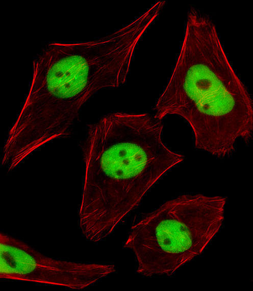 SUMO2 + SUMO3 Antibody - Fluorescent image of U251 cells stained with SUMO2/3 Antibody. Antibody was diluted at 1:25 dilution. An Alexa Fluor 488-conjugated goat anti-rabbit lgG at 1:400 dilution was used as the secondary antibody (green). Cytoplasmic actin was counterstained with Alexa Fluor 555 conjugated with Phalloidin (red).