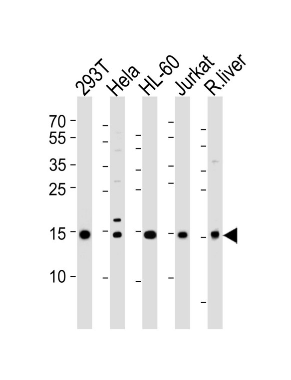 SUMO2 + SUMO3 Antibody - Western blot of lysates from 293T, HeLa, HL-60, Jurkat cell lines and rat liver tissue lysate (from left to right), using SUMO2/3 Antibody (Q65). Antibody was diluted at 1:1000 at each lane. A goat anti-rabbit IgG H&L (HRP) at 1:5000 dilution was used as the secondary antibody. Lysates at 35ug per lane.