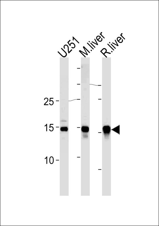 SUMO2 + SUMO3 Antibody - SUMO2/3 Antibody western blot of U251 cell lysate,mouse liver and rat liver tissue lysates (35 ug/lane). This demonstrates that the SUMO2/3 antibody detected SUMO2/3 protein (arrow).