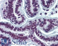 SUMO2 + SUMO3 Antibody - Anti-SUMO2 antibody IHC of human breast. Immunohistochemistry of formalin-fixed, paraffin-embedded tissue after heat-induced antigen retrieval. Antibody concentration 5 ug/ml.