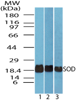 Superoxide Dismutase Antibody - Western blot of SOD in liver lysate of 1) human, 2) mouse and 3) rat using Superoxide Dismutase Antibody at 0.025 ug/ml.