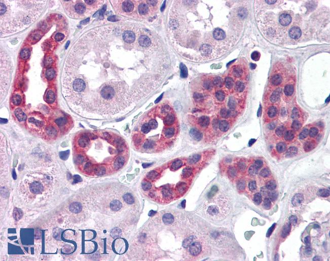 SUPT16H / FACTP140 Antibody - Anti-SUPT16H antibody IHC of human kidney. Immunohistochemistry of formalin-fixed, paraffin-embedded tissue after heat-induced antigen retrieval. Antibody concentration 3.75 ug/ml.