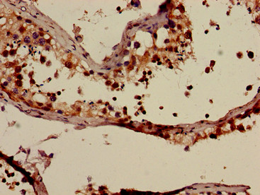 SUR2 / ABCC9 Antibody - Immunohistochemistry of paraffin-embedded human testis tissue using ABCC9 Antibody at dilution of 1:100