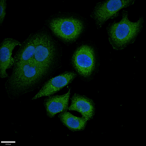 SUR2 / ABCC9 Antibody - Immunofluorescent analysis of A549 cells using ABCC9 Antibody at a dilution of 1:100 and Alexa Fluor 488-congugated AffiniPure Goat Anti-Rabbit IgG(H+L)