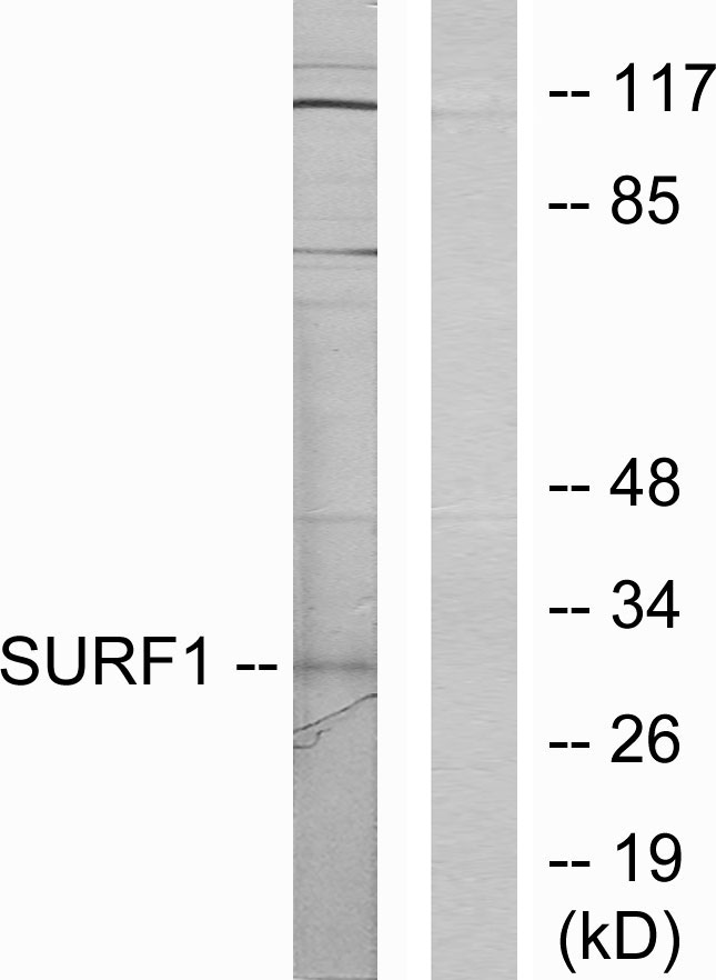 SURF1 Antibody - Western blot analysis of lysates from Jurkat cells, using SURF1 Antibody. The lane on the right is blocked with the synthesized peptide.