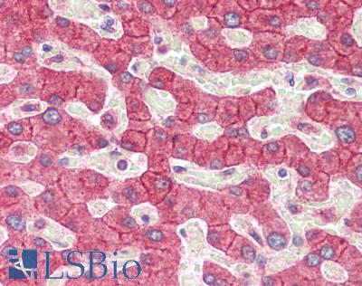 SUSD1 Antibody - Human Liver: Formalin-Fixed, Paraffin-Embedded (FFPE)