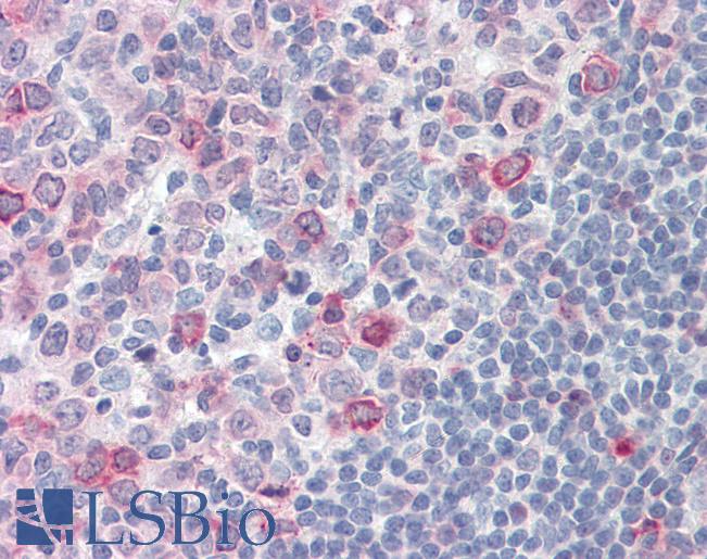 SUSD2 Antibody - Anti-SUSD2 antibody IHC of human tonsil. Immunohistochemistry of formalin-fixed, paraffin-embedded tissue after heat-induced antigen retrieval.