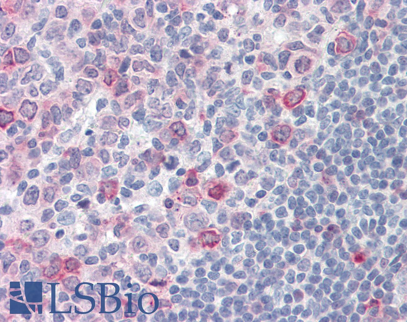 SUSD2 Antibody - Anti-SUSD2 antibody IHC of human tonsil. Immunohistochemistry of formalin-fixed, paraffin-embedded tissue after heat-induced antigen retrieval.