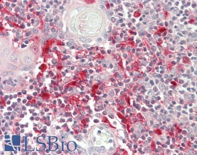 SUSD3 Antibody - Human Thymus: Formalin-Fixed, Paraffin-Embedded (FFPE)