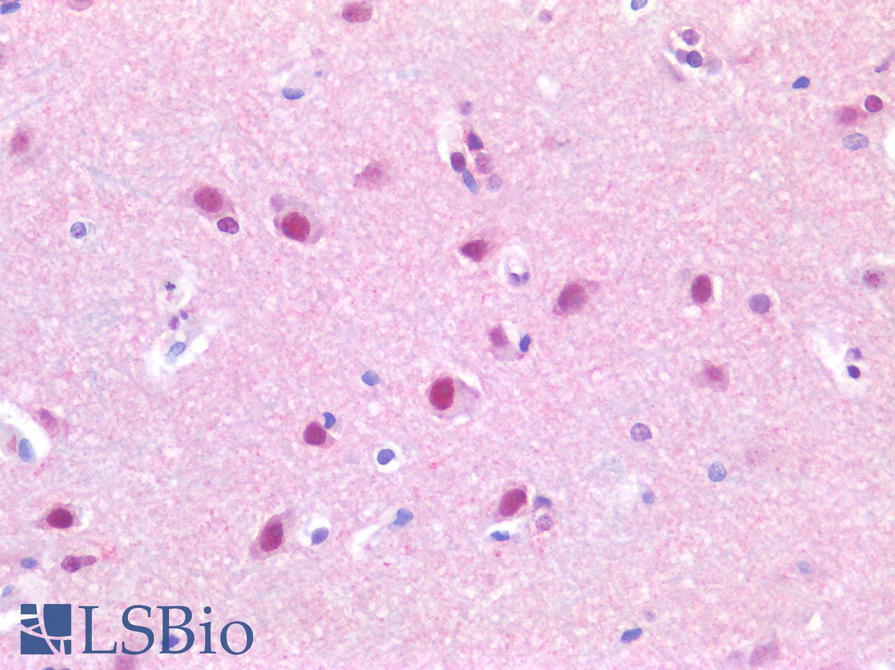 SUV420H1 Antibody - Human Brain, Cortex: Formalin-Fixed, Paraffin-Embedded (FFPE)