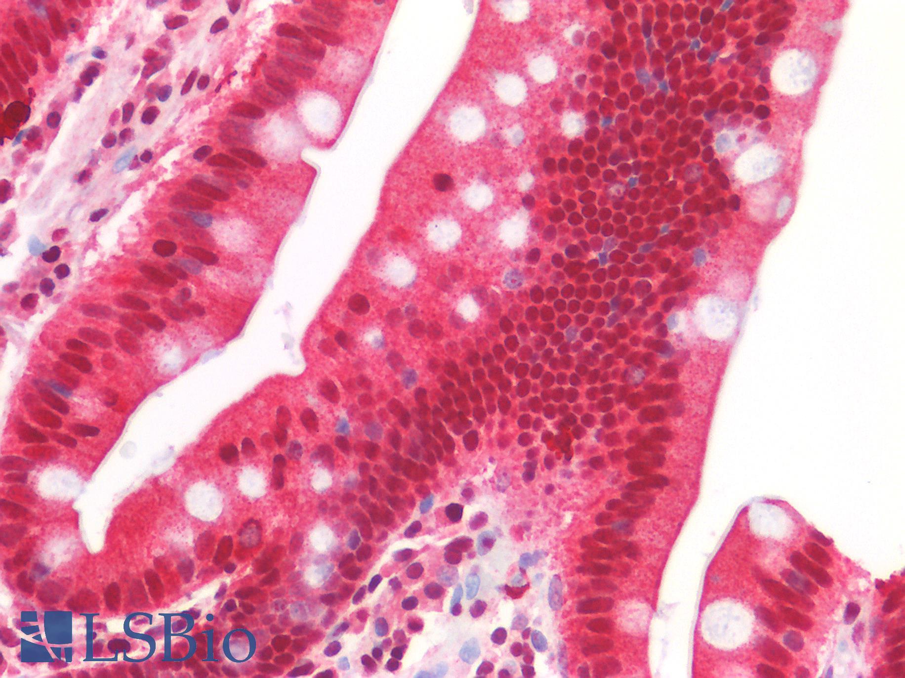 SUV420H1 Antibody - Human Small Intestine: Formalin-Fixed, Paraffin-Embedded (FFPE)
