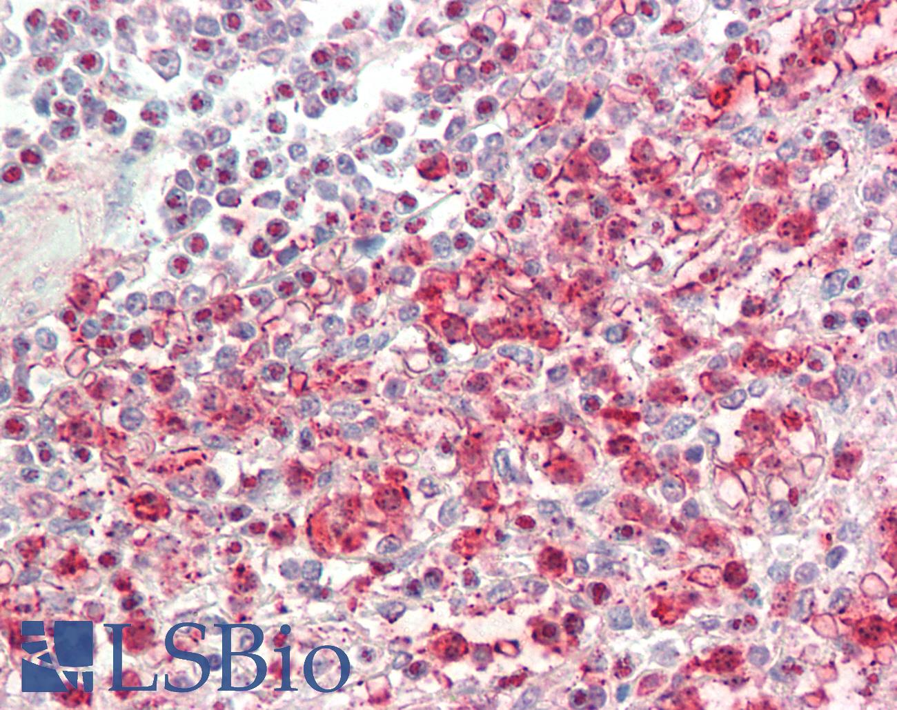 SUZ12 Antibody - Anti-SUZ12 antibody IHC staining of human spleen. Immunohistochemistry of formalin-fixed, paraffin-embedded tissue after heat-induced antigen retrieval. Antibody dilution 1:100.