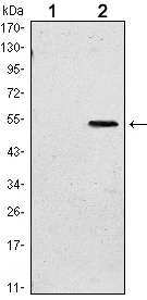 SUZ12 Antibody - Western blot using SUZ12 monoclonal antibody against HEK293 (1) and SUZ12(AA: 533-739)-hIgGFc transfected HEK293 (2) cell lysate.