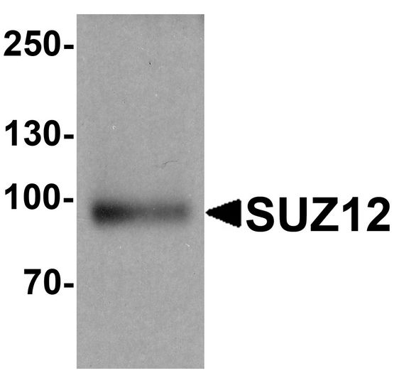 SUZ12 Antibody - Western blot analysis of SUZ12 in human liver tissue lysate with SUZ12 antibody at 1 ug/ml.