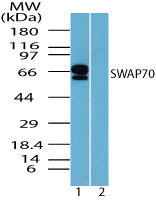 SWAP70 Antibody - Western blot of SWAP70 in human spleen lysate in the 1) absence and 2) presence of immunizing peptide using SWAP70 Antibody at 0.25 ug/ml.