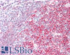 SWAP70 Antibody - Human Tonsil: Formalin-Fixed, Paraffin-Embedded (FFPE)
