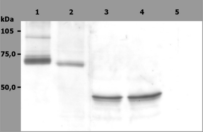 SYK Antibody - Western Blotting analysis (non-reducing conditions) of whole cell lysate of RAMOS human Burkitt lymphoma cell line (1), RBL rat basophilic leukemia cell line (2) and HeLa human cervix carcinoma cell line (3, 4).  Lane 1, 2: immunostaining with anti-Syk (SYK-01)  Lane 3, 4: immunostaining with anti-human Cytokeratin 18 (DC-10)  Lane 5: negative control