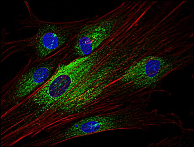 SYK Antibody - Immunofluorescence staining of Syk in human primary fibroblasts using anti-Syk (SYK-01; green). Actin cytoskeleton was decorated by phalloidin (red) and cell nuclei stained with DAPI (blue).
