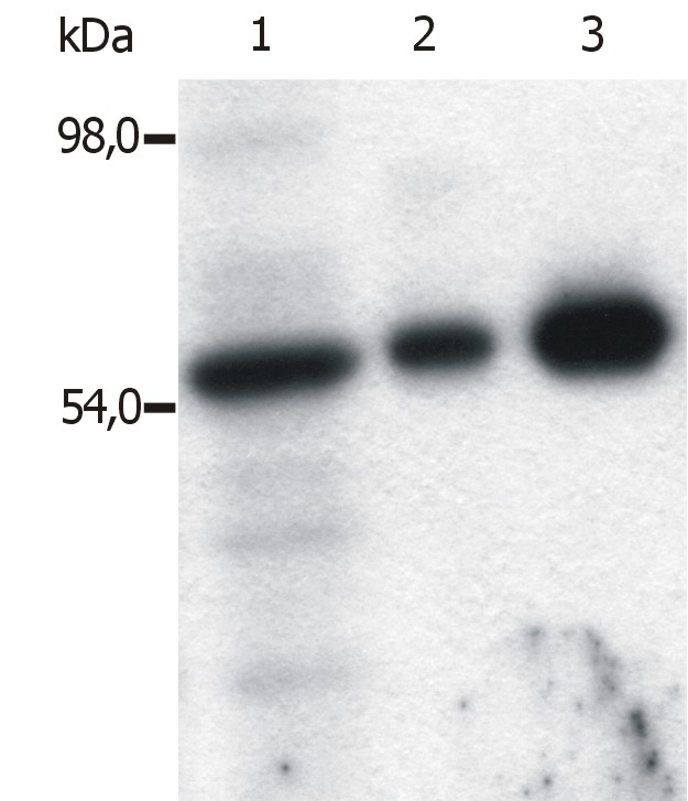 SYN / FYN Antibody - Immunoprecipitation of Fyn from the lysate of T cells isolated from fresh buffy coats. Western blot was immunostained with anti-Fyn (FYN-01).  Lane 1: original lysate of T cells  Lane 2-3: Immunoprecipitated material eluted from affinity sorbent (FYN-01 coupled to Sepharose beads). Lanes differ in amount of T cell lysate loaded on the immunosorbent.