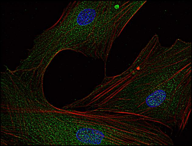 SYN / FYN Antibody - Immunofluorescence staining of Fyn in human primary fibroblasts using anti-Fyn (FYN-01; green). Actin cytoskeleton was decorated by phalloidin (red) and cell nuclei stained with DAPI (blue).           Primary antibody: 5 ug/ml