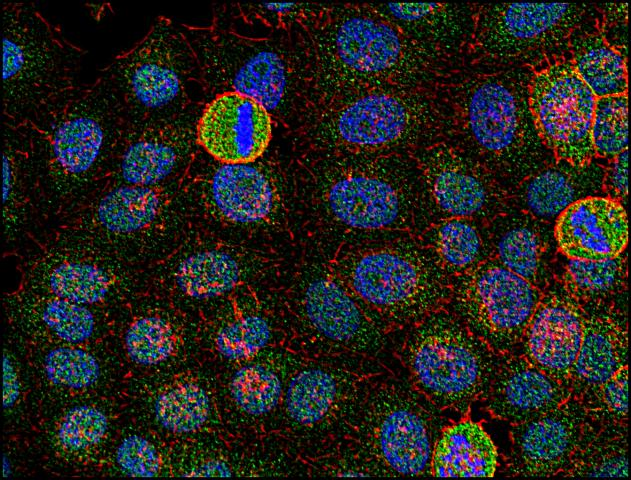 SYN / FYN Antibody - Immunofluorescence staining of Fyn in human HeLa cell line using anti-Fyn (FYN-01; green). Actin cytoskeleton was decorated by phalloidin (red) and cell nuclei stained with DAPI (blue).