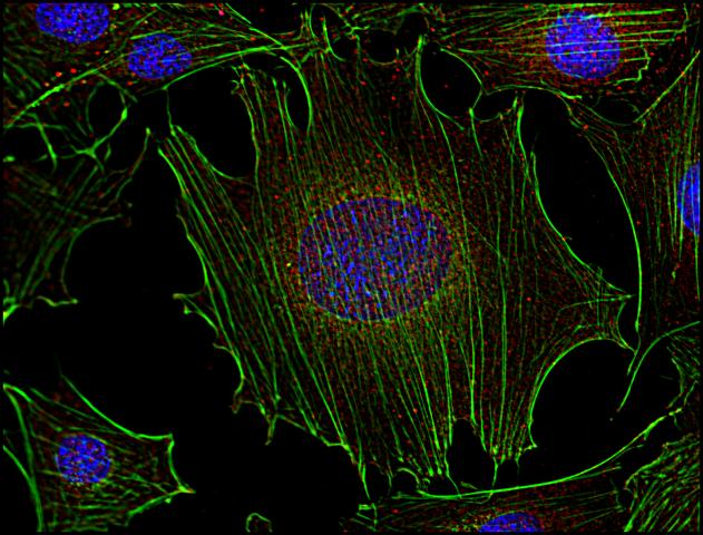 SYN / FYN Antibody - Immunofluorescence staining of Fyn in murine transformed fibroblasts using anti-Fyn (FYN-01; red). Actin cytoskeleton was decorated by phalloidin (green) and cell nuclei stained with DAPI (blue).